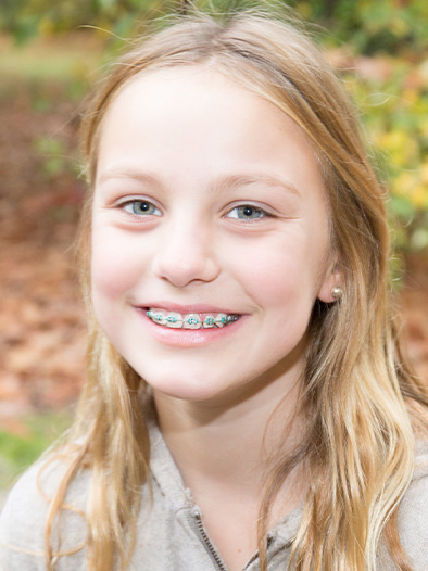 Early Orthodontic Treatment - Murray Orthodontics | Sanford Kennebunk ME